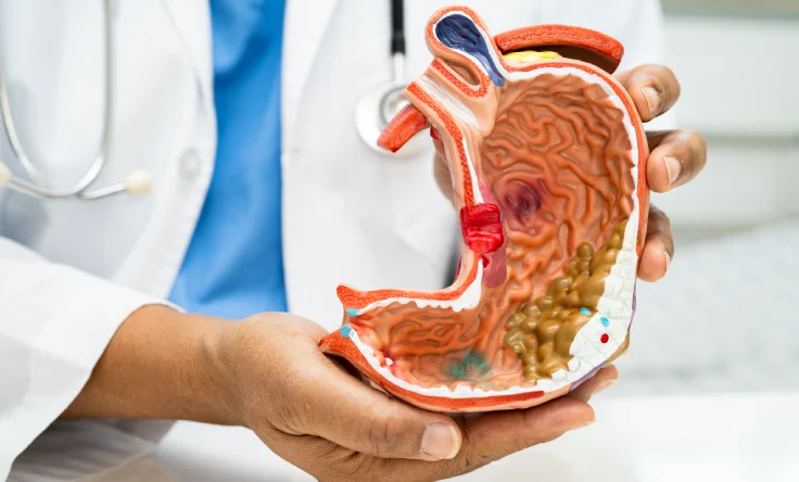 Gastrointestinal