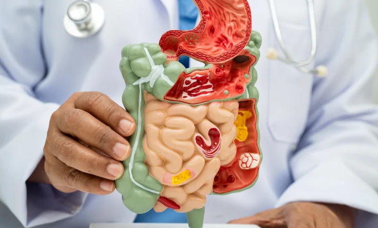 Gut health